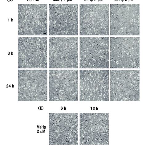 Time And Dose Dependent Change In Cell Morphology In Cultured