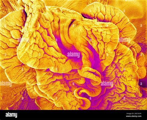 Fimbriae Of A Fallopian Tube Coloured Scanning Electron Micrograph Sem Fimbriae Are The