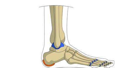 Bruised Heel Injury - Muscle Pull | Muscle Pull