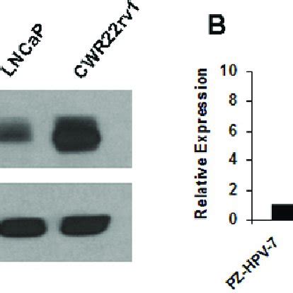 Gene Expression Of Foxm In Human Non Malignant Prostate Epithelial