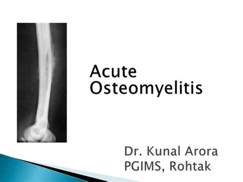 Acute Osteomyelitis Ppt