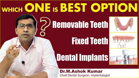 Best Teeth Replacement Options Fixed Teeth Vs Removable Teeth