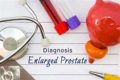 PROCEPT Stock: Novel Water-Based System For Enlarged Prostate Treatment ...