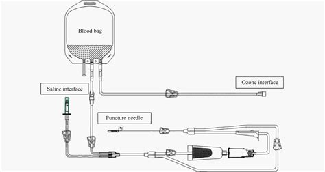 Expert Consensus On Standard Operating Procedures For Autologous