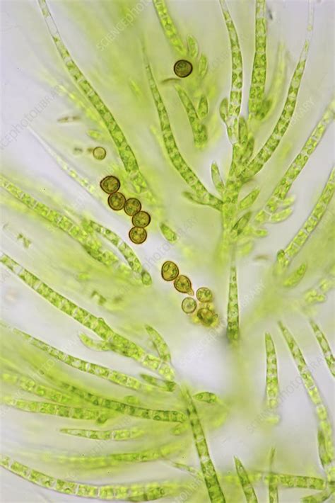 Draparnaldia Green Algae Light Micrograph Stock Image C0491456