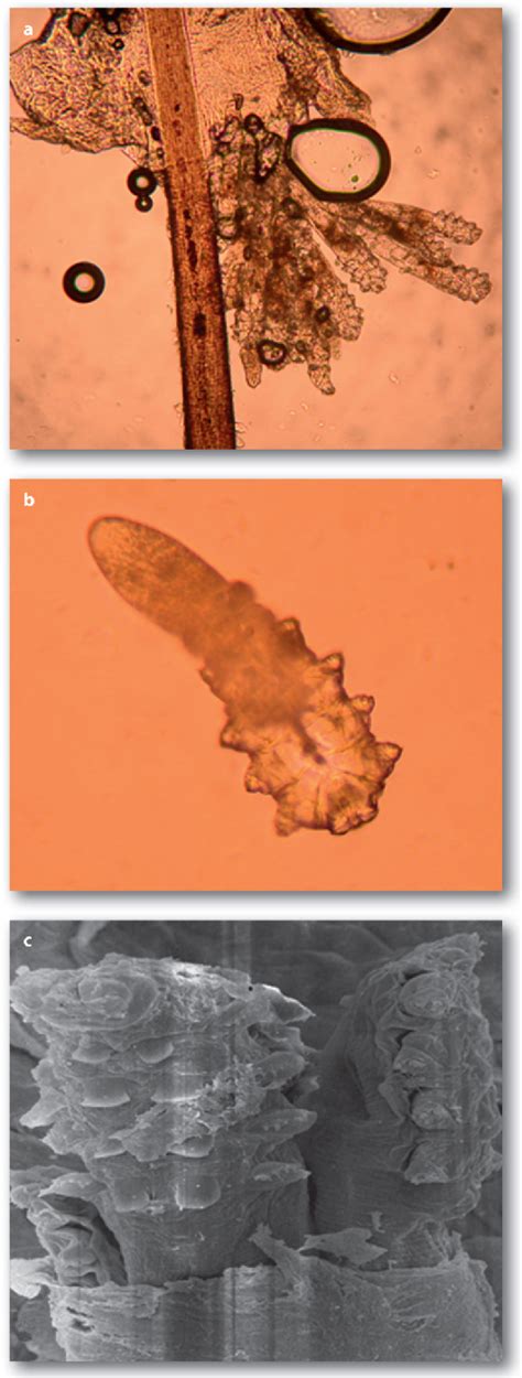 Demodex Mite Semantic Scholar