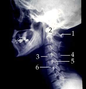 Lab Vertebral Column And Thoracic Cage