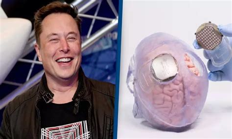 Neuralink S Brain Implant All Set For Human Trials Says Musk