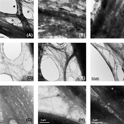 Scanning Electron Micrographs Of Human Dermal Fibroblasts Hdfs