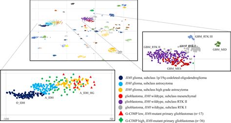 Molecular Landscape Of Idh Mutant Primary Astrocytoma Grade Iv