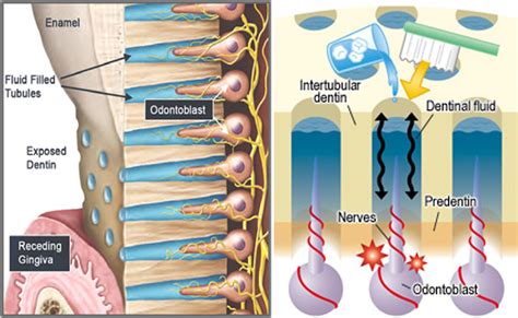 Características generales de la sensibilidad dental