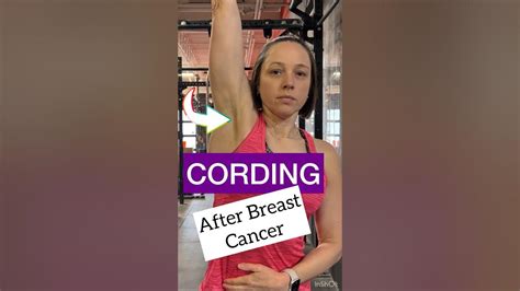 Get Rid Of Cording Axillary Web Syndrome Breastcancer Youtube