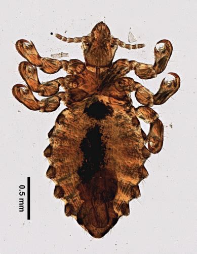 Arthropods Vi Lice Flashcards Quizlet