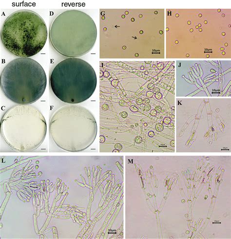 Morphological Characteristics Of Trichoderma Cyanodichotomus Tw