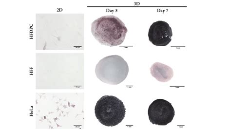 Alkaline Phosphatase Staining In 2d And 3d Cultures Hfdpc Were Download Scientific Diagram