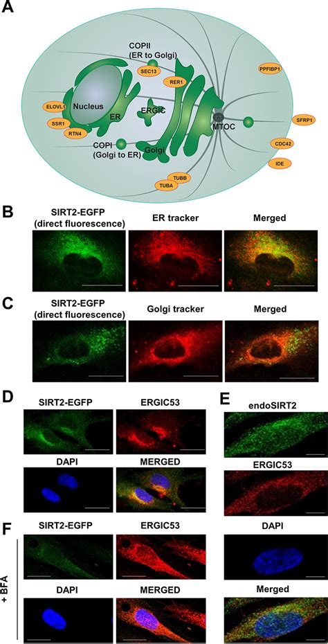 Human Sirtuin Localization Transient Interactions And Impact On The