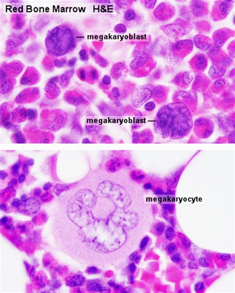 Normal Bone Marrow Histology