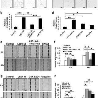 Lsd Suppresses Invasion Migration Of Luminal Breast Cancer Cells A