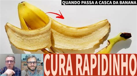 Quando Passa A Casca Da Banana Cura Rapidinho As Gr Vidas Usam Muito