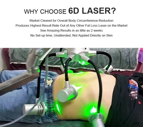 Class 4 Laser Therapy Luxmaster Slim 6d Lipo Laser 532nm Laser Green