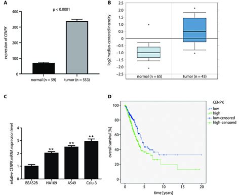 The Overexpression Of Cenpk And Its Association With Cancer Prognosis