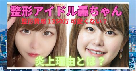 轟ちゃんは整形したのに可愛くないと炎上！整形総費用は驚愕の1350万円超え！画像23枚で変化を比較してみた。