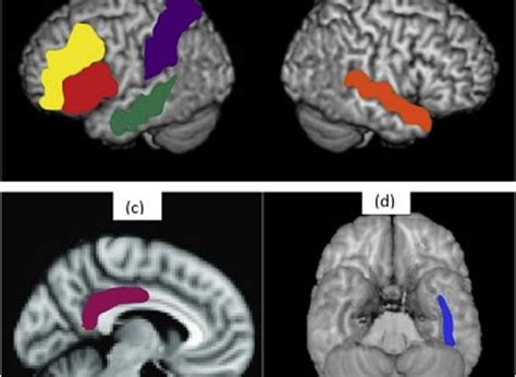 Middle Temporal Gyrus