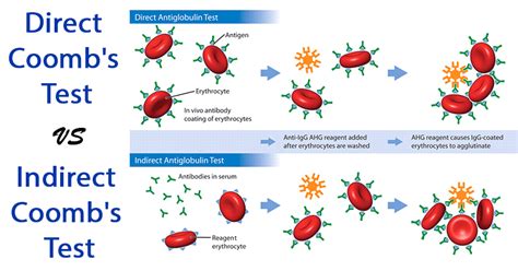 Coomb S Test Direct And Indirect Coomb S Test