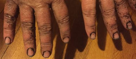 how to clean dirt from under nails