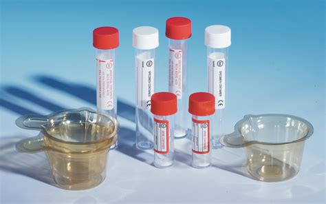 Urine Containers For Primary Samples International Scientific