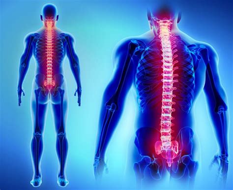 Coluna Vertebral Entenda Toda A Sua Estrutura Itc Vertebral