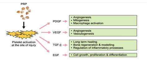 The Next Big Thing in PRP Therapy - A Medical Analysis