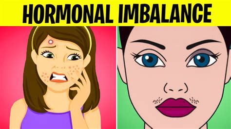 12 Signs Of Hormonal Imbalance In Women YouTube