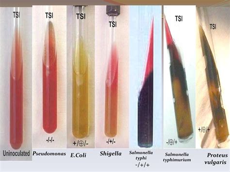 Triple Sugar Iron Tsi Agar Principle Results And 50 Off