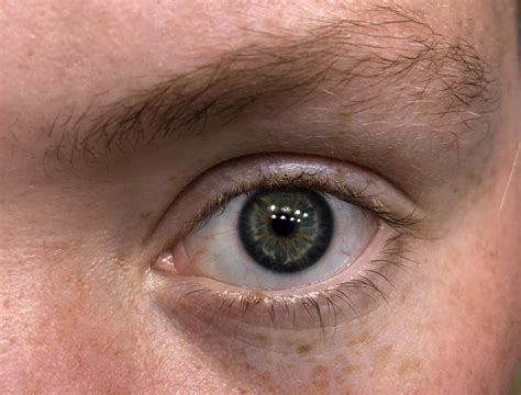 Hello I think they are green? This eye is also blind! I only have one working eye! : r/eyes