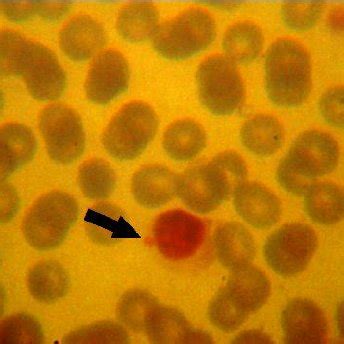 (PDF) Seroprevalence and Risk Factors of Ehrlichia canis Infection ...