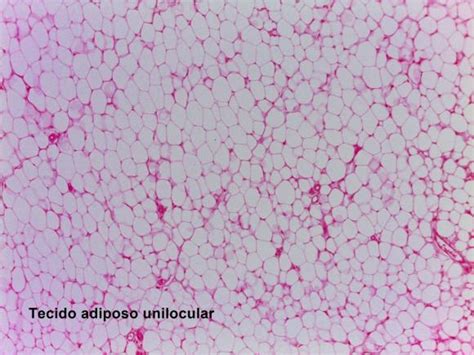 Tecido Adiposo Unilocular - Tecido Adiposo- Laminas | Histologia e Embriologia