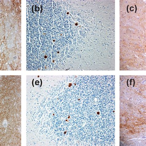 Immunolabelling Of Prp Sc In Scjd And Bse Brain Tissue Samples