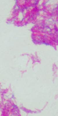 Mycobacterium bovis - Quip Labs