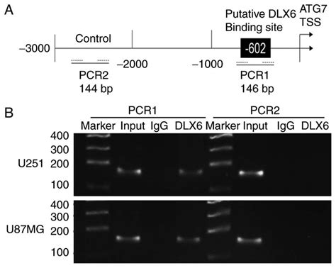 Chromatin Immunoprecipitation Assay Demonstrated That Dlx6 Directly