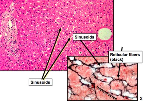 Liver Histology Sinusoids