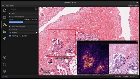 Slideflow Deep Learning For Digital Histopathology With Real Time