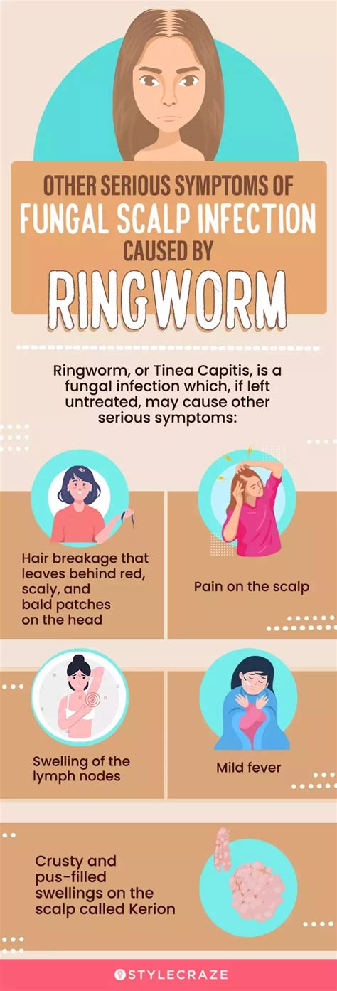 8 Home Remedies To Get Rid Of Scalp Fungus Prevention Tips Artofit