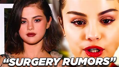 Selena Gomez Plastic Surgery Rumors And Her Health Issues Lupus Youtube