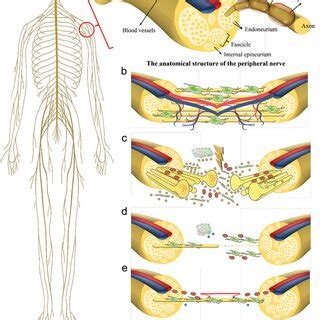 Three Potential Elements Of Developing Nerve Guidance Conduit For