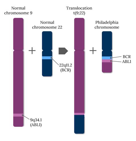 Chronic Myeloid Leukemia CML CCEdit