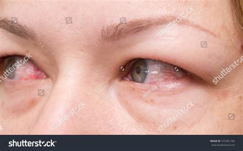 Close Shot Red Eyes Stock Photo 572381746 Shutterstock