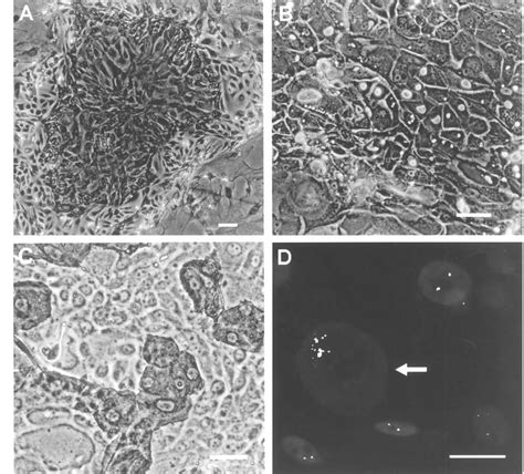 Human Mammary Epithelial Cells Cultured From BT18 Tumor Tissue A The