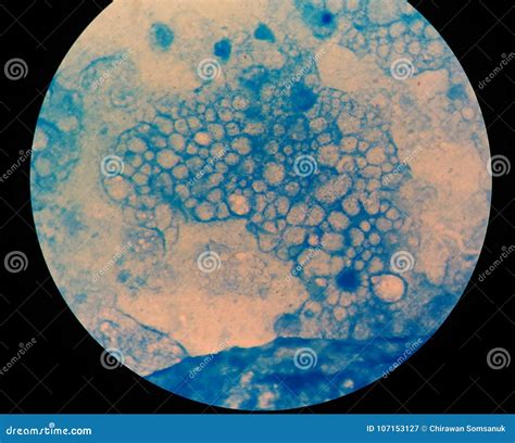 Acid Fast Bacilli Negative on Blue. Stock Image - Image of hematoxylin ...