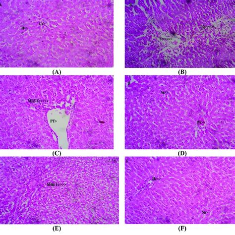 Photomicrographs Of Representative Liver Sections Normal Control Shows Download Scientific